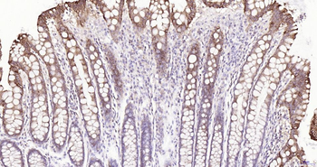 Frizzled 8 Recombinant Rabbit Monoclonal Antibody