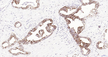 Frizzled 8 Recombinant Rabbit Monoclonal Antibody