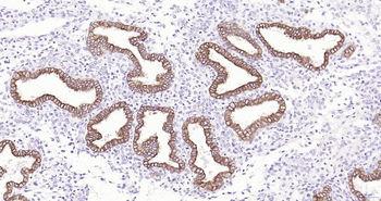 Frizzled 8 Recombinant Rabbit Monoclonal Antibody