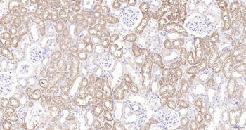 Frizzled 8 Recombinant Rabbit Monoclonal Antibody