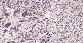 RalA Recombinant Rabbit Monoclonal Antibody