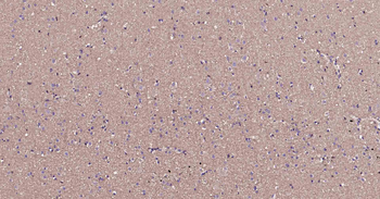RalA Recombinant Rabbit Monoclonal Antibody