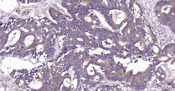 RalA Recombinant Rabbit Monoclonal Antibody