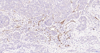 CD105 Recombinant Rabbit Monoclonal Antibody