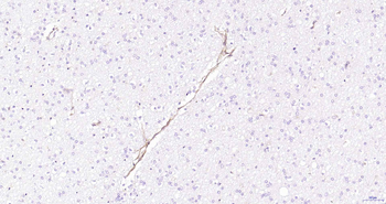 CD105 Recombinant Rabbit Monoclonal Antibody