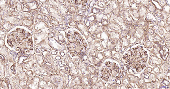 CD105 Recombinant Rabbit Monoclonal Antibody