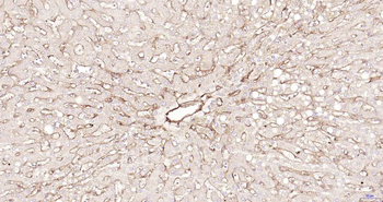 CD105 Recombinant Rabbit Monoclonal Antibody