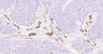 CD105 Recombinant Rabbit Monoclonal Antibody