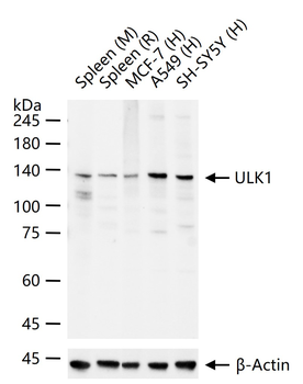 ULK1 Recombinant Rabbit Monoclonal Antibody