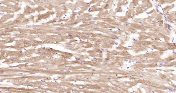 ULK1 Recombinant Rabbit Monoclonal Antibody