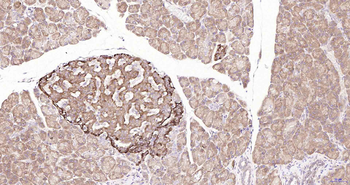 ULK1 Recombinant Rabbit Monoclonal Antibody