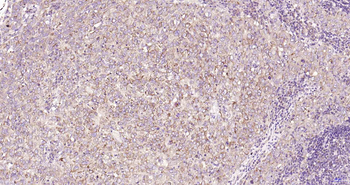 ULK1 Recombinant Rabbit Monoclonal Antibody