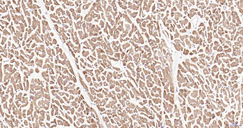 ULK1 Recombinant Rabbit Monoclonal Antibody
