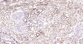 ULK1 Recombinant Rabbit Monoclonal Antibody