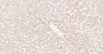 ULK1 Recombinant Rabbit Monoclonal Antibody