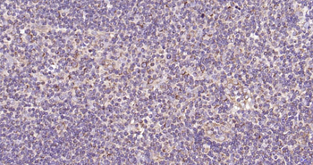 ULK1 Recombinant Rabbit Monoclonal Antibody