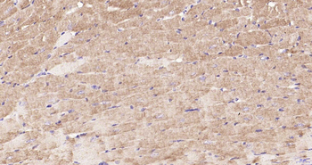 ULK1 Recombinant Rabbit Monoclonal Antibody