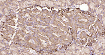 ULK1 Recombinant Rabbit Monoclonal Antibody