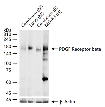 PDGF Receptor beta Recombinant Rabbit Monoclonal Antibody