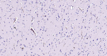 PDGF Receptor beta Recombinant Rabbit Monoclonal Antibody