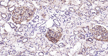 PDGF Receptor beta Recombinant Rabbit Monoclonal Antibody