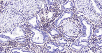 PDGF Receptor beta Recombinant Rabbit Monoclonal Antibody