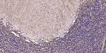 AQP4 Recombinant Rabbit Monoclonal Antibody