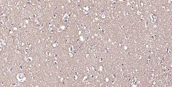 AQP4 Recombinant Rabbit Monoclonal Antibody