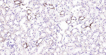 AQP4 Recombinant Rabbit Monoclonal Antibody