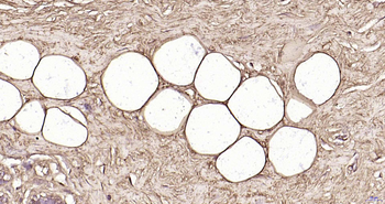 Perilipin A Recombinant Rabbit Monoclonal Antibody