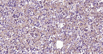 Perilipin A Recombinant Rabbit Monoclonal Antibody