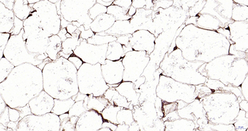 Perilipin A Recombinant Rabbit Monoclonal Antibody