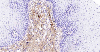 Collagen VI Recombinant Rabbit Monoclonal Antibody