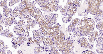 Collagen VI Recombinant Rabbit Monoclonal Antibody