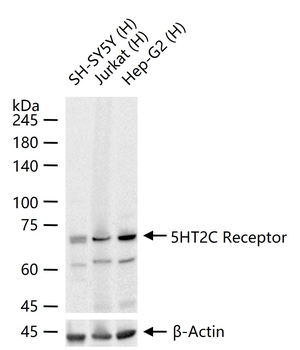 5HT2C Receptor Recombinant Rabbit Monoclonal Antibody