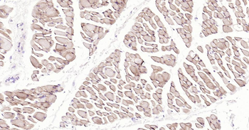Dystrophin Recombinant Rabbit Monoclonal Antibody