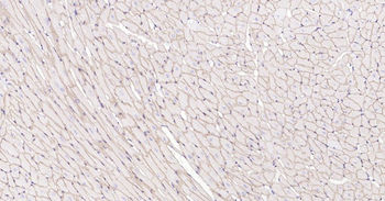 Dystrophin Recombinant Rabbit Monoclonal Antibody