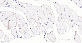 Dystrophin Recombinant Rabbit Monoclonal Antibody
