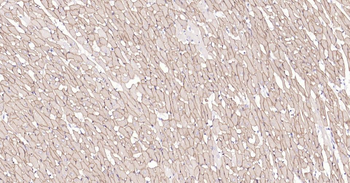 Dystrophin Recombinant Rabbit Monoclonal Antibody