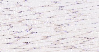 Dystrophin Recombinant Rabbit Monoclonal Antibody