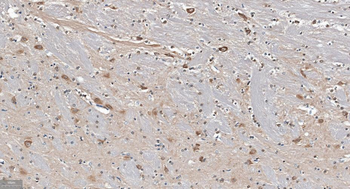 GABARAP Recombinant Rabbit Monoclonal Antibody