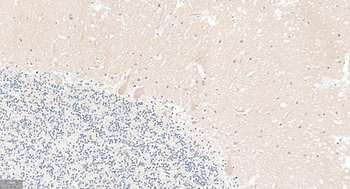 GABARAP Recombinant Rabbit Monoclonal Antibody