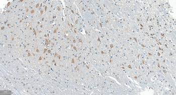 GABARAP Recombinant Rabbit Monoclonal Antibody