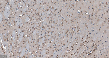 GABARAP Recombinant Rabbit Monoclonal Antibody