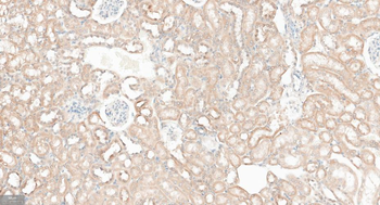 GABARAP Recombinant Rabbit Monoclonal Antibody