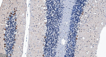 GABARAP Recombinant Rabbit Monoclonal Antibody