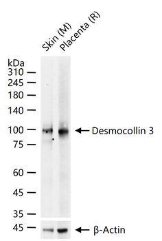 Desmocollin 3 Recombinant Rabbit Monoclonal Antibody