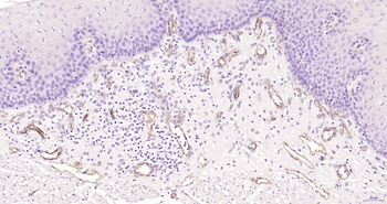 Claudin 5 Recombinant Rabbit Monoclonal Antibody