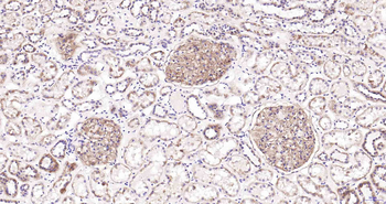 Claudin 5 Recombinant Rabbit Monoclonal Antibody