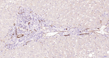 Claudin 5 Recombinant Rabbit Monoclonal Antibody